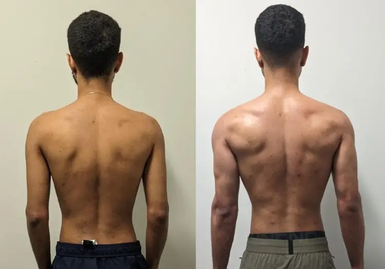Client transformation — Back & posture · 24 weeks