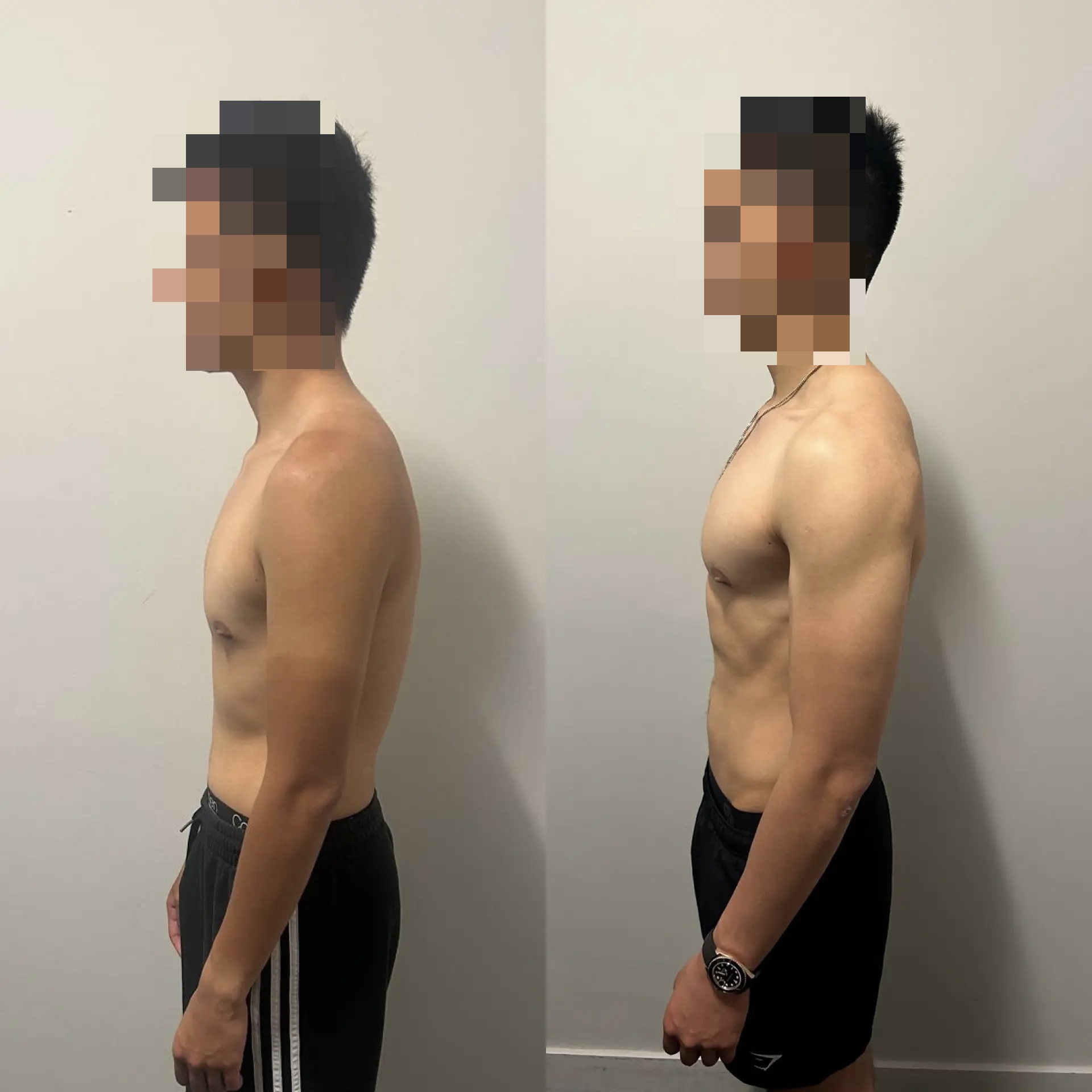 Client transformation — Lean recomp · 18 weeks